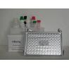 Buy cheap Infectious Disease HBsAg Elisa Kit Hepatitis B Surface Antigen Elisa Test from wholesalers