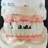 Buy cheap Titanium Malo Bridge Implant Bridge Without Multi Unit Abutment Cementable from wholesalers