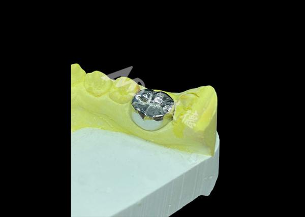 Long-lasting Function Durable Full Metal Cast Crown for Superior Tooth