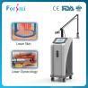 Buy cheap co2 laser head portable lens machine from wholesalers
