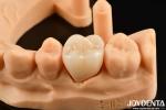 High Wear Resistance Dental Full Zirconia High Strength Full Contour Zirconia
