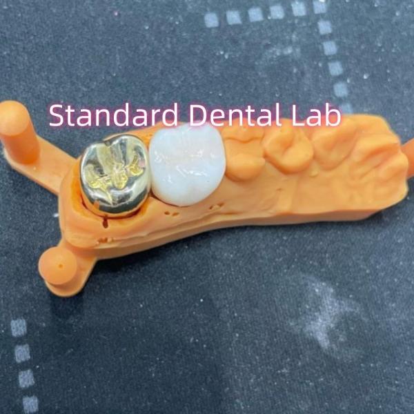 Buy cheap Non Precious Yellow Metal Alloy Crown Full Cast With Zirconia Crown from wholesalers