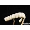 Buy cheap Custom-made Zirconia Excellent Strength for Individualized Dental Solutions from wholesalers