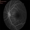 Buy cheap 35mm Fundus Imaging System Equipment Auto Focus Shooting from wholesalers