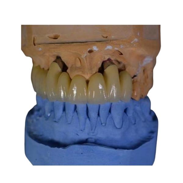 Buy cheap FDA PFM Crown Porcelain fused to Metal Crown from wholesalers