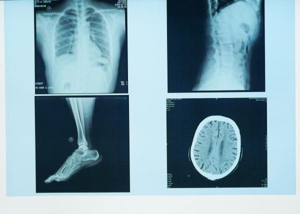 Buy cheap Durable X Ray Diagnostic Imaging , 32cm x 43cm Medical Paper Laser Blue X Ray Film from wholesalers