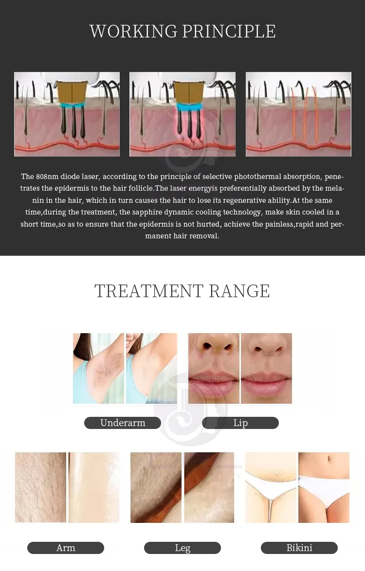2 In 1 808/755/1064Nm Laser Diode Permanent Lazer Hair Removal Device Skin Rejuvenation Tattoo Removal