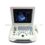 Clinic Hospital Obstetrics and Gynecology Department Laptop Ultrasound Machine