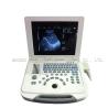 Buy cheap Clinic Hospital Obstetrics and Gynecology Department Laptop Ultrasound Machine with Battery from wholesalers