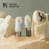 Buy cheap Single Crowns Zirconia Abutment Hypoallergenic Dental Implant Zirconia Abutment from wholesalers