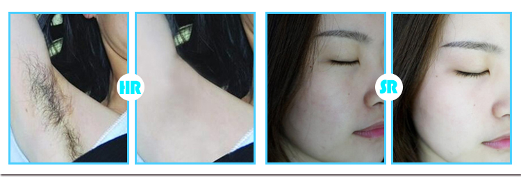Factory Cheap Price Portable IPL Machine Hair Remover