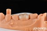 Translucent Zirconia Disc Block For Inlay Onlay Crown Restorations And Bridge