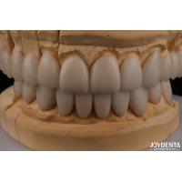 Buy cheap 0.3mm Thickness Ips Emax Veneers Ceramic Veneers Anterior Posterior Restorations product