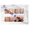 Buy cheap HIFU Beauty Skin Tightening Machine , HIFU Face Lifting Machine 4.0MHz from wholesalers