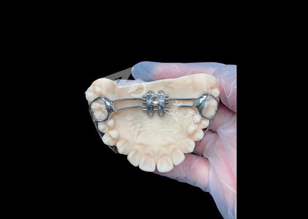 Buy cheap MSE Palatal Expander Innovative Orthodontic Appliances For Effective Teeth Alignment from wholesalers