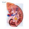 Buy cheap Enlarged Kidney Human Anatomical Model 1 Part Medical Life Size from wholesalers