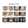 Buy cheap RF 360 Cryolipolysis Slimming Machine Non Invasive Cavitation ISO90 Approval from wholesalers