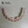 Buy cheap Nature Implant Procedure Cases with Universal Compatibility and Optimal Performance from wholesalers