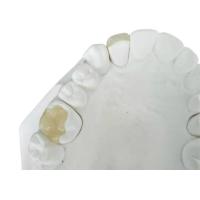 Buy cheap Durable Flexible PFM Bridge Crown Dental IPS E Max Press Inlay Onlay product