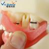 Buy cheap Peridontal Disease Teeth Study Model Human Dental Model Gingival Diseases from wholesalers