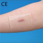 Latex Free Adhesive Hydrocolloid Wound Dressing Sterilization CMC Yellow