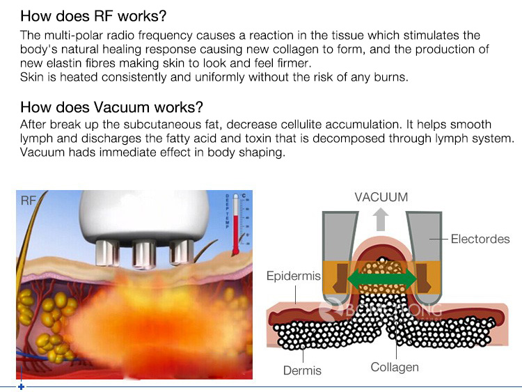 80k Ultrasonic Vacuum Cavitation System Weight Loss RF Cellulite Removal Body Slimming 80k Cavitation Machine