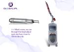 Nd Yag 12ns 7mm 532nm 400m Tattoo Removal Equipment