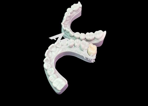Buy cheap Precise Fit Zirconia Dental Crown Aesthetic Natural Colour Excellent Biocompatibility from wholesalers