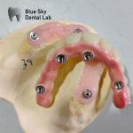 Universal Dental Implant Case Compatible With Multiple Implant Systems