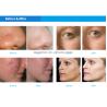 Buy cheap H2o2 Hydrogen Skin Rejuvenation Machine RF Micro Bubble Beauty from wholesalers