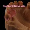 Buy cheap Dental TCS Valplast Flexible Partial Dentures Nesbit Valplast Finish China Dental Lab Valplast Clasp from wholesalers