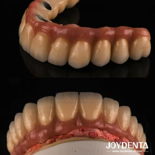 Buy cheap Casting And Milling PFM Tooth Crown , Dental Restorations Porcelain Fused Metal Crown from wholesalers