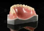 Lucitone 199 Full Denture Acrylic Teeth Heat Curing Acrylic Complete Denture