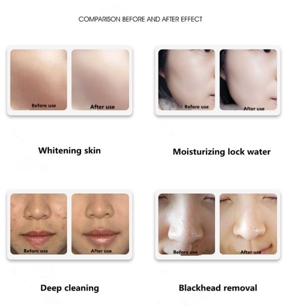 Salon used water dermabrasion /Hydra microdermabrasion machine/spa facial cleaning Hydro Dermabrasion machine