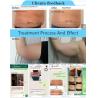 Buy cheap 2019 Best Professional Fat Freeze Criolipolisis Machine Cryolipolysis Multi-Functional beauty equipment Cryolipolyse from wholesalers