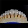 Buy cheap Dental Lab Teeth Feldspathic Porcelain Veneers Custom Shaped from wholesalers