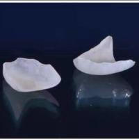Buy cheap Natural Looking All Porcelain Veneers EMAX Dental Crown product