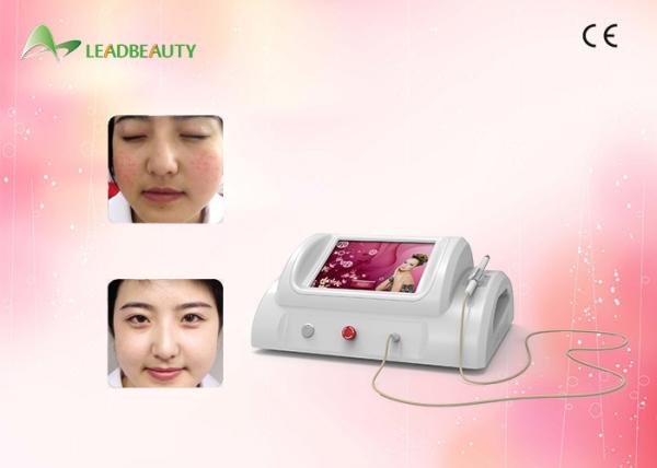 Buy cheap 30MHz RBS portable facial veinwave vascular spider veins removal beauty machine from wholesalers