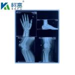 Customized Size Blue PET Based X Ray Inkjet/ Laser Film Medical Images For