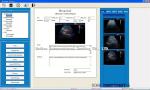 New Arrival Hospital 10.4 Inch Ultrasound echography