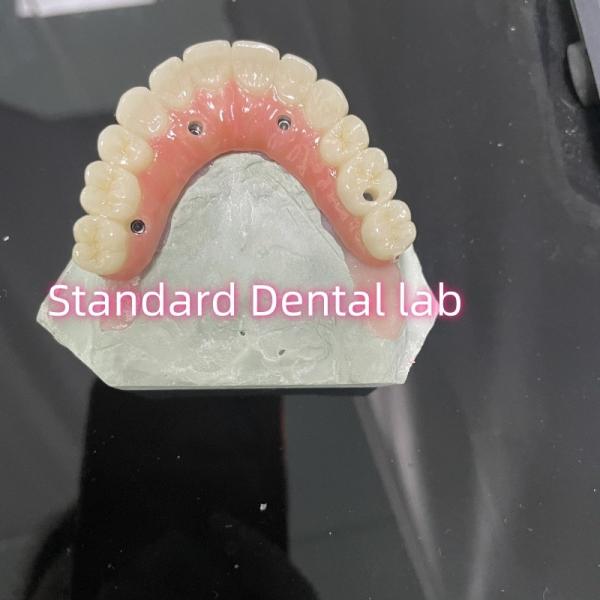Buy cheap All On Four Six Ivoclar Zirconia Implant Bridge TItanium Bar With Pink Gum Porcelain from wholesalers