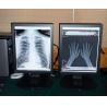 Buy cheap medical high quality 2MP Color medical display from wholesalers