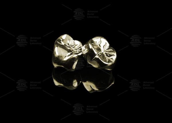 Buy cheap Sleek Full Cast Metal Crown Precious Alloy Gold 20% Polished Full Metal Dental Crown from wholesalers