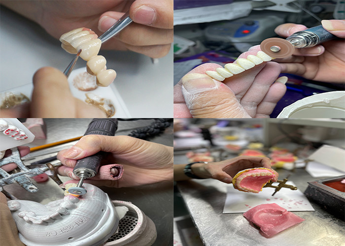 Translucent Natural Looking Zirconia dental Crown with Excellent Durability and Precise Fit