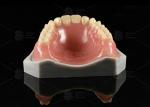 Lucitone 199 Full Denture Acrylic Teeth Heat Curing Acrylic Complete Denture