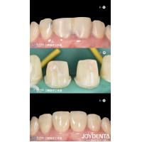 Buy cheap Perfectly Fit teeth Zirconia Dental Crowns With CAD CAM Systems For Precision product