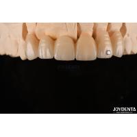 Buy cheap CAD / CAM Milling Dental Layered Zirconia For Single Crowns 0.3-0.5mm Layer product