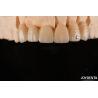 Buy cheap CAD / CAM Milling Dental Layered Zirconia For Single Crowns 0.3-0.5mm Layer Thickness from wholesalers