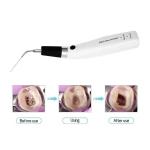 Dental Cordless Ultrasonic Activator Equipment Sonic Irrigator Endo Activator