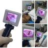 Buy cheap Disposable Laryngoscope Blades VS Reusable Fexible For Fiberoptic Laryngoscopy Diagnostic from wholesalers